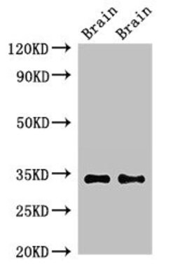 Invitrogen Neuropeptide Y Receptor 6 Polyclonal Antibody 100 μg; Unconjugated:Antibodies,