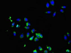 Invitrogen SMO Polyclonal Antibody 100 &mu;g; Unconjugated:Antibodies,
