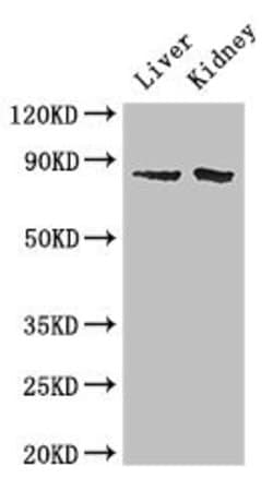 Invitrogen SMO Polyclonal Antibody 100 &mu;g; Unconjugated:Antibodies,