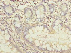 Invitrogen FAM118B Polyclonal Antibody 100 μg; Unconjugated:Antibodies,