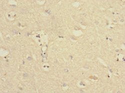 Invitrogen PTPN18 Polyclonal Antibody 100 &mu;L; Unconjugated:Antibodies,
