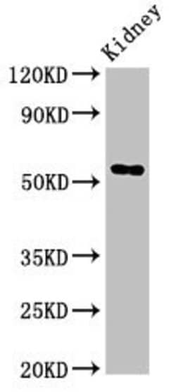 Invitrogen FUCA1 Polyclonal Antibody 100 μg; Unconjugated:Antibodies,