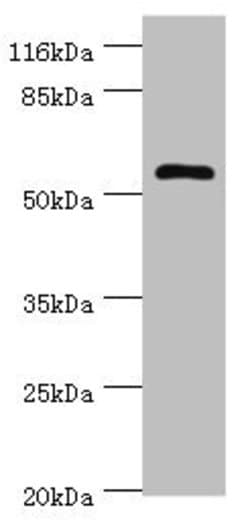 Invitrogen DPH2 Polyclonal Antibody 100 &mu;g; Unconjugated:Antibodies,