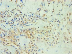 SPIN2 Polyclonal Antibody, Invitrogen 100 &mu;L; Unconjugated:Antibodies,