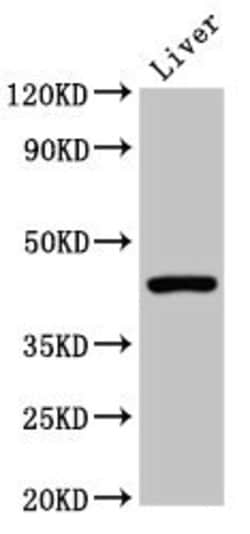 Invitrogen CD299 (DC-SIGN/L) Polyclonal Antibody 100 &mu;g; Unconjugated:Antibodies,