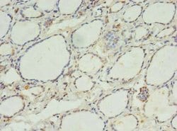Invitrogen CK068 Polyclonal Antibody 100 &mu;g; Unconjugated:Antibodies,