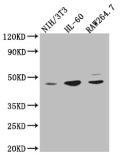 Invitrogen ZDHHC6 Polyclonal Antibody 100 &mu;g; Unconjugated:Antibodies,