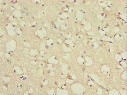 Invitrogen TCEAL7 Polyclonal Antibody 100 μg; Unconjugated:Antibodies,