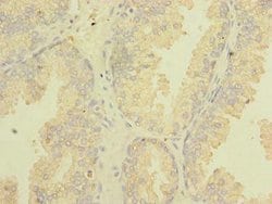 Invitrogen TSGA10 Polyclonal Antibody 100 &mu;g; Unconjugated:Antibodies,