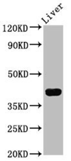 Invitrogen RASSF7 Polyclonal Antibody 100 &mu;g | Buy Online | Invitrogen&trade; | Fisher Scientific