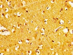 Invitrogen NAT10 Polyclonal Antibody 100 &mu;g; Unconjugated:Antibodies,