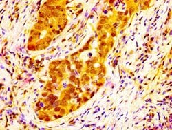 Invitrogen NAT10 Polyclonal Antibody 100 &mu;g; Unconjugated:Antibodies,