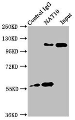 Invitrogen NAT10 Polyclonal Antibody 100 &mu;g; Unconjugated:Antibodies,