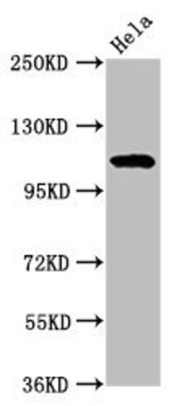 Invitrogen NAT10 Polyclonal Antibody 100 &mu;g; Unconjugated:Antibodies,