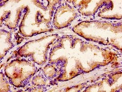 Invitrogen ACBD3 Polyclonal Antibody 100 &mu;g; Unconjugated:Antibodies,
