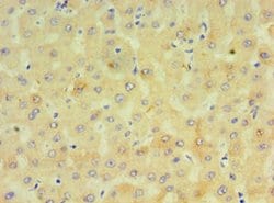 Invitrogen CYP4F12 Polyclonal Antibody 100 &mu;L; Unconjugated:Antibodies,