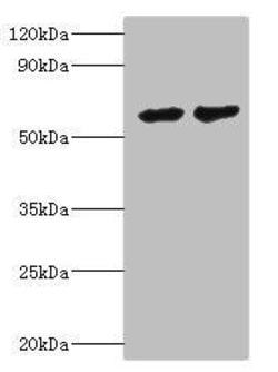 Invitrogen CYP4F12 Polyclonal Antibody 100 &mu;L; Unconjugated:Antibodies,