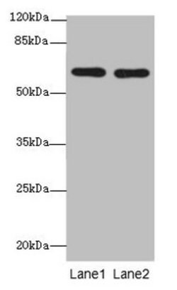 Invitrogen CNOT2 Polyclonal Antibody 100 μg; Unconjugated:Antibodies,