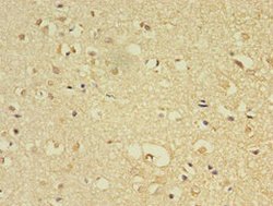 Invitrogen FLRT1 Polyclonal Antibody 100 μg; Unconjugated:Antibodies,