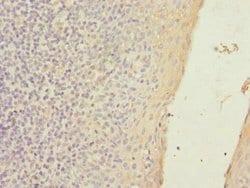 Invitrogen SLC23A2 Polyclonal Antibody 100 &mu;L | Buy Online | Invitrogen&trade; | Fisher Scientific