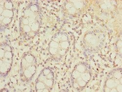 Invitrogen SLC23A2 Polyclonal Antibody 100 &mu;L | Buy Online | Invitrogen&trade; | Fisher Scientific