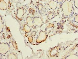 Invitrogen FYCO1 Polyclonal Antibody 100 &mu;g; Unconjugated:Antibodies,