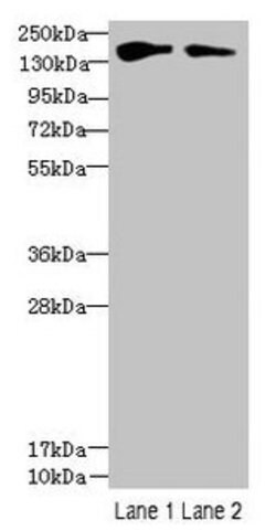 Invitrogen FYCO1 Polyclonal Antibody 100 &mu;g; Unconjugated:Antibodies,