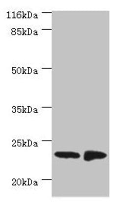 Invitrogen C7orf50 Polyclonal Antibody 100 &mu;g; Unconjugated:Antibodies,