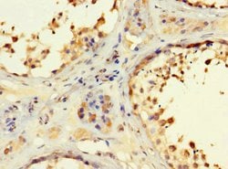 Invitrogen RSPH9 Polyclonal Antibody 100 &mu;g; Unconjugated:Antibodies,