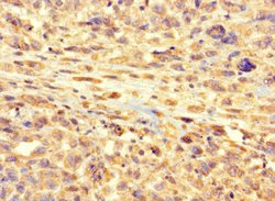 Invitrogen RSPH9 Polyclonal Antibody 100 &mu;g; Unconjugated:Antibodies,