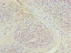 Invitrogen TUBB1 Polyclonal Antibody 100 μg; Unconjugated:Antibodies,
