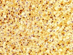 Invitrogen SEMA4B Polyclonal Antibody 100 &mu;g; Unconjugated:Antibodies,