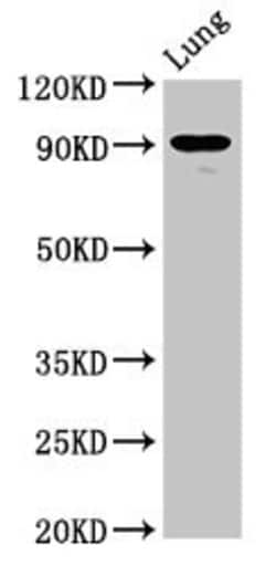 Invitrogen SEMA4B Polyclonal Antibody 100 &mu;g; Unconjugated:Antibodies,
