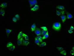 Invitrogen SEMA5B Polyclonal Antibody 100 μg; Unconjugated:Antibodies,