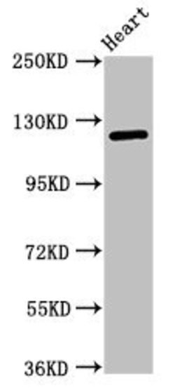 Invitrogen SEMA5B Polyclonal Antibody 100 μg; Unconjugated:Antibodies,