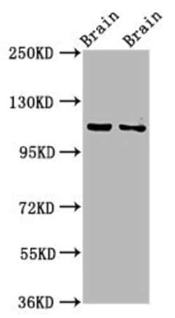 Invitrogen CLIP2 Polyclonal Antibody 100 &mu;g | Buy Online | Invitrogen&trade; | Fisher Scientific