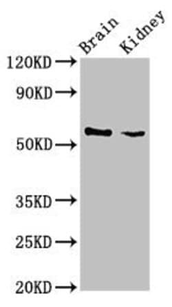 Invitrogen SLC25A23 Polyclonal Antibody 100 &mu;g; Unconjugated:Antibodies,