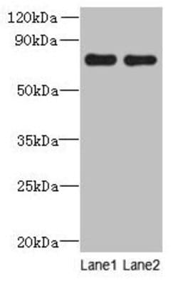Invitrogen ACTR8 Polyclonal Antibody 100 &mu;g; Unconjugated:Antibodies,