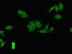 Invitrogen CSN7b Polyclonal Antibody 100 &mu;g; Unconjugated:Antibodies,