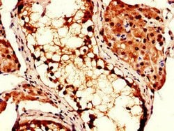 Invitrogen CSN7b Polyclonal Antibody 100 &mu;g; Unconjugated:Antibodies,