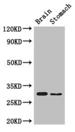 Invitrogen CSN7b Polyclonal Antibody 100 &mu;g; Unconjugated:Antibodies,