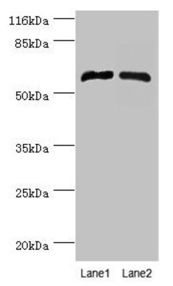 Invitrogen CYP4F11 Polyclonal Antibody 100 &mu;g | Buy Online | Invitrogen&trade; | Fisher Scientific