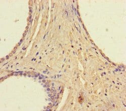 Invitrogen RAVER2 Polyclonal Antibody 100 &mu;g; Unconjugated:Antibodies,