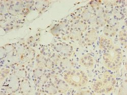 Invitrogen ZDHHC4 Polyclonal Antibody 100 &mu;g; Unconjugated:Antibodies,