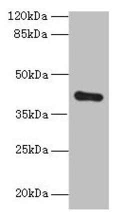 Invitrogen ZDHHC4 Polyclonal Antibody 100 &mu;g; Unconjugated:Antibodies,