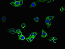 Invitrogen SLC52A3 Polyclonal Antibody 100 &mu;g; Unconjugated:Antibodies,