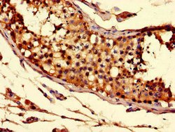 Invitrogen SLC52A3 Polyclonal Antibody 100 &mu;g; Unconjugated:Antibodies,