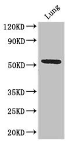 Invitrogen SLC52A3 Polyclonal Antibody 100 &mu;g; Unconjugated:Antibodies,