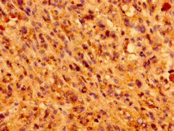 Invitrogen IFT46 Polyclonal Antibody 100 μg; Unconjugated:Antibodies,