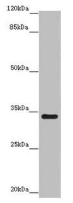 Invitrogen IFT46 Polyclonal Antibody 100 μg; Unconjugated:Antibodies,